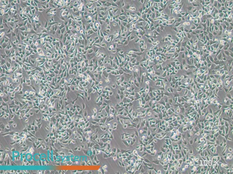 CHP-212 Cell Complete MediumCHP-212 Cell Complete Medium - 3