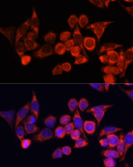 Immunofluorescence analysis of HeLa cells using TLR2 Polyclonal Antibody at dilution of 1:100. Blue: DAPI for nuclear staining.