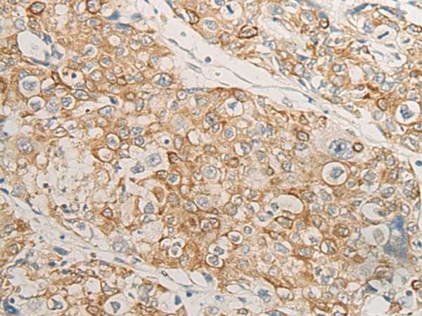 HLA-DMB Polyclonal Antibody - small - 2