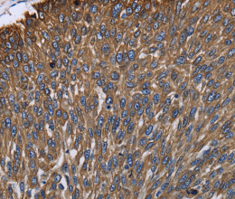 KRT31 Polyclonal Antibody - 3