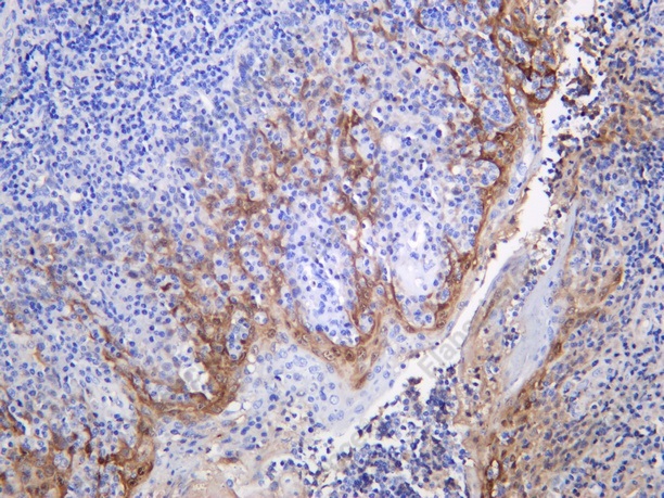 Recombinant NDRG1 (Phospho Thr346) Monoclonal Antibody - 1