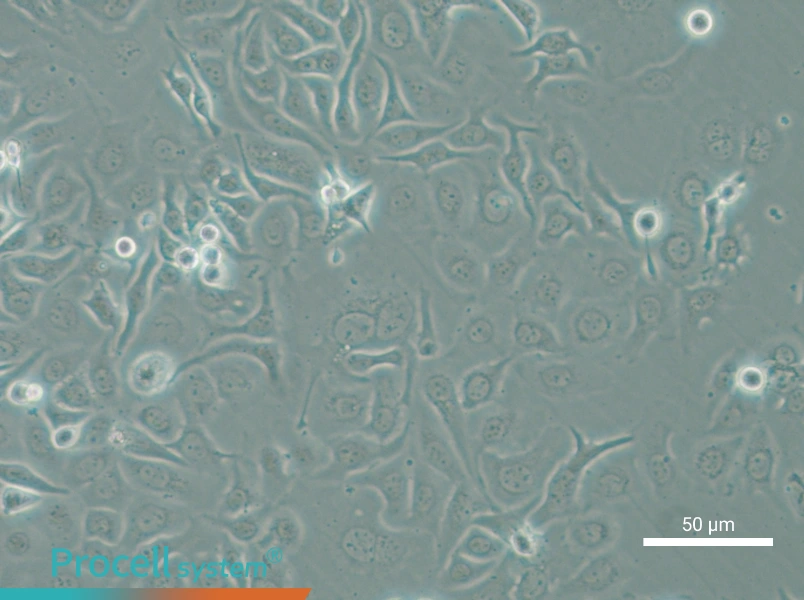 HCC1143 - 5