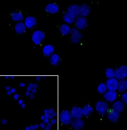 Recombinant Glypican-3 Monoclonal Antibody - small - 5