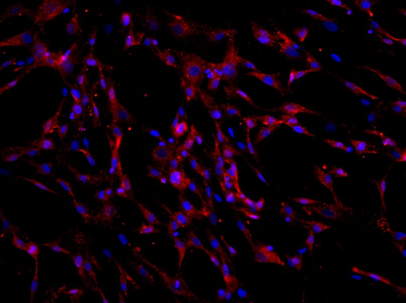Human Bone Marrow Mesenchymal Stem Cell Complete Medium - 2