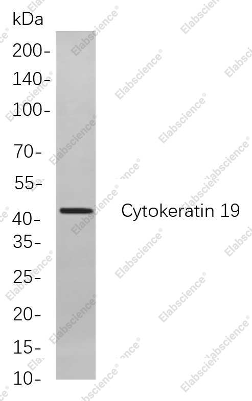 Recombinant Cytokeratin 19 Monoclonal Antibody - 1