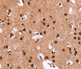 RPSA Polyclonal Antibody - 3
