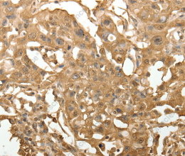 TXN Polyclonal Antibody - 3