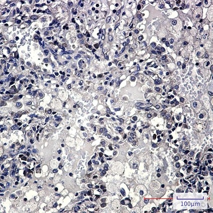 Recombinant ZYX Monoclonal Antibody - 5