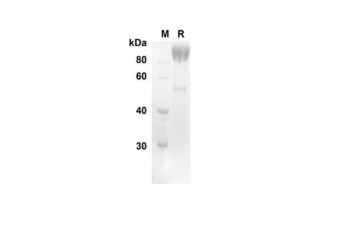 Recombinant Mouse TNF RI/TNFRSF1A Protein(Gst Tag)-产品推荐-1