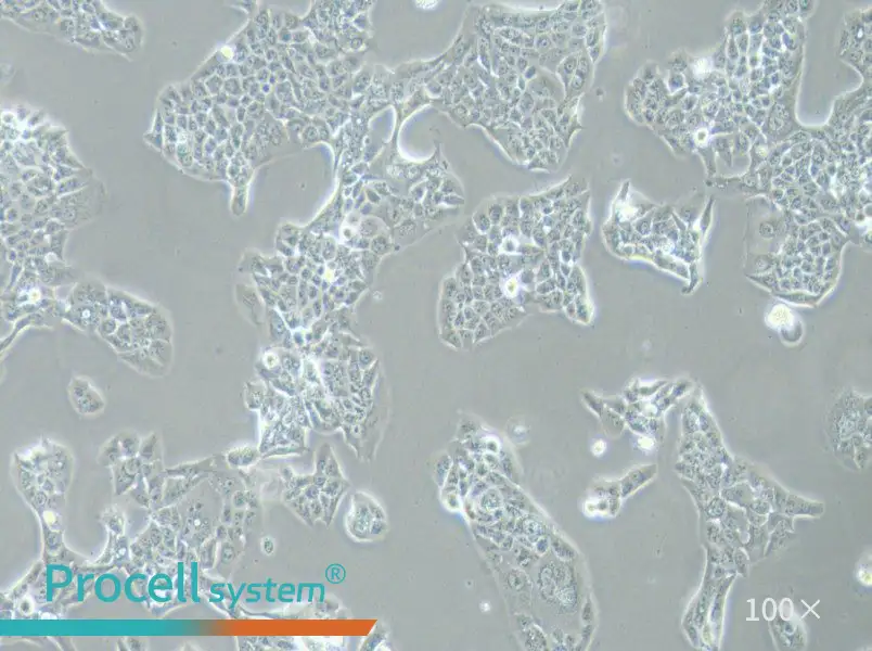 NCI-H441 Cell Complete Medium - 1