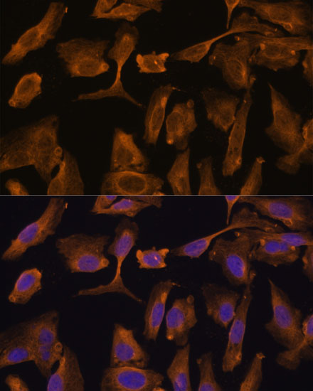 Immunofluorescence analysis of U-2 OS cells using MTMR4 Polyclonal Antibody at dilution of  1:100 (40x lens). Blue: DAPI for nuclear staining.