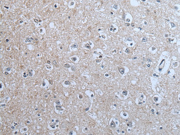 Immunohistochemistry of paraffin-embedded Human brain tissue  using BRSK2 Polyclonal Antibody at dilution of 1:70(?200)