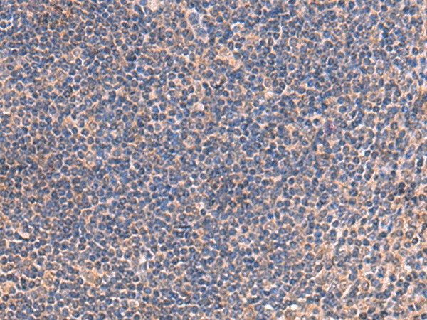 Immunohistochemistry of paraffin-embedded Human tonsil tissue  using IP6K2 Polyclonal Antibody at dilution of 1:45(?200)