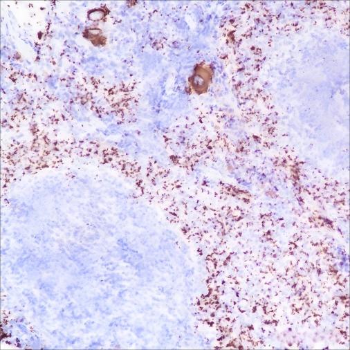 Recombinant CD42b Monoclonal Antibody - 3