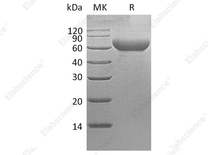 Recombinant Cynomolgus TIM-3/HAVCR2 Protein (Fc Tag) - 1
