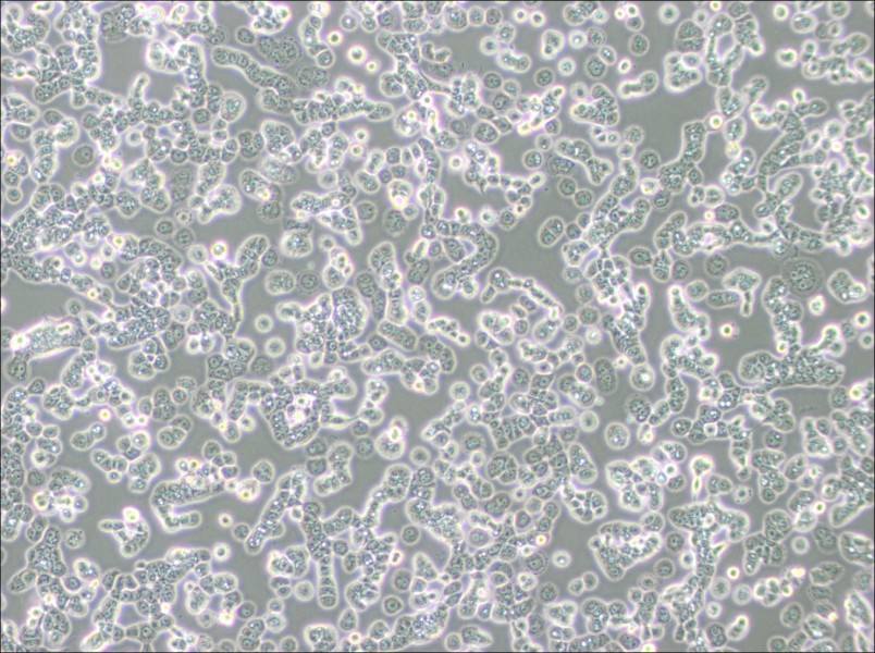 NCI-H2087 [H2087] Cell Complete MediumNCI-H2087 [H2087] Cell Complete Medium - 3