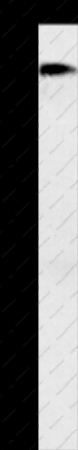 ACE1 Polyclonal Antibody - 1