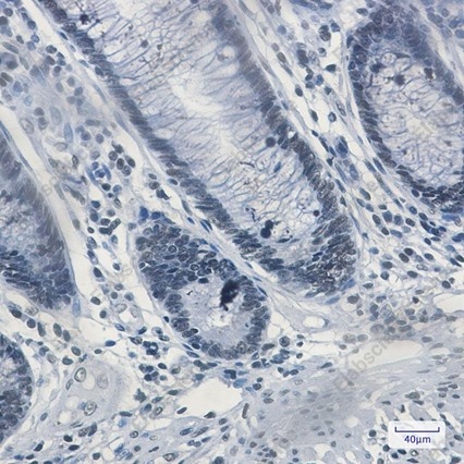 Recombinant Matrin 3 Monoclonal Antibody - 4