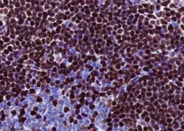 Recombinant MEF2C Monoclonal Antibody-searchlist-2