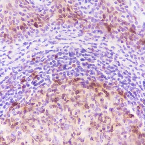 Recombinant Stathmin Monoclonal Antibody - 3