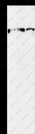 KIF3A Polyclonal Antibody - 1
