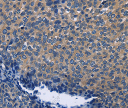 SYT17 Polyclonal Antibody - 2