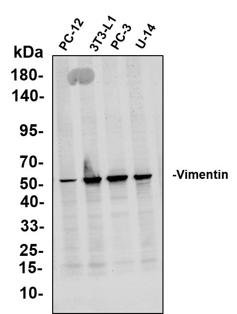 Recombinant Vimentin Monoclonal Antibody - 1