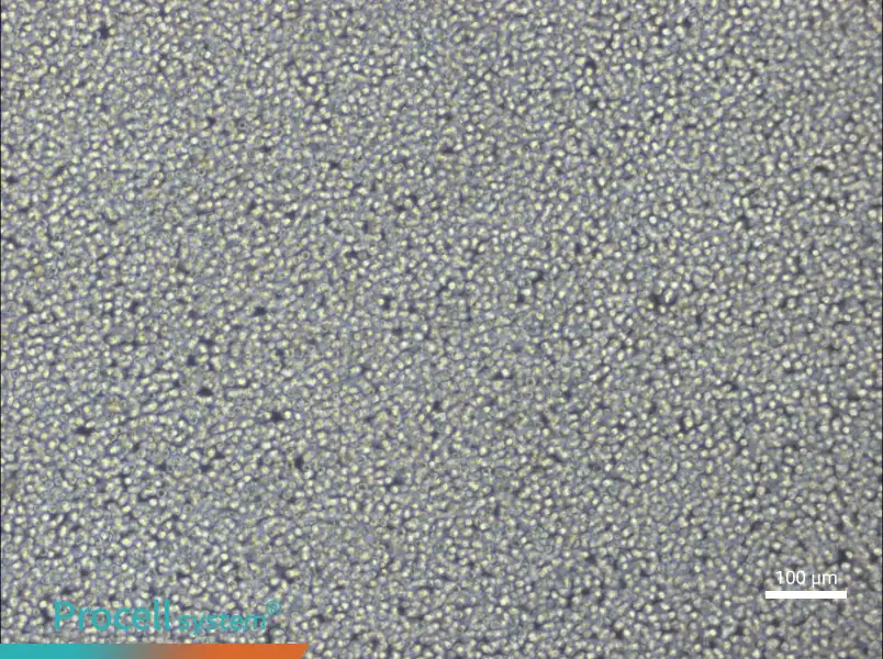 NCI-H929 - 1