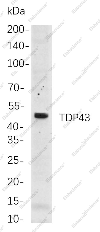 Recombinant TDP43 Monoclonal Antibody - 1