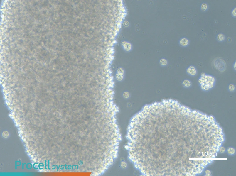 HH [Human lymphoma]HH [Human lymphoma] - 2