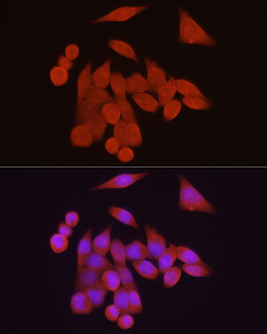 Immunofluorescence analysis of HeLa cells using VDR Polyclonal Antibody at dilution of 1:200 (40x lens). Blue: DAPI for nuclear staining.