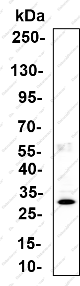 Recombinant CITED2 Monoclonal Antibody - 2