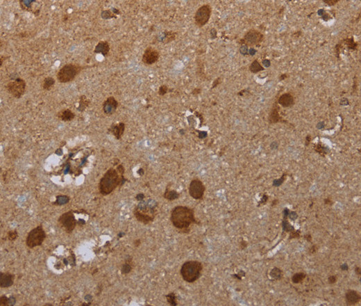 Immunohistochemistry of paraffin-embedded Human brain  tissue using ATP2A1 Polyclonal Antibody at dilution 1:30