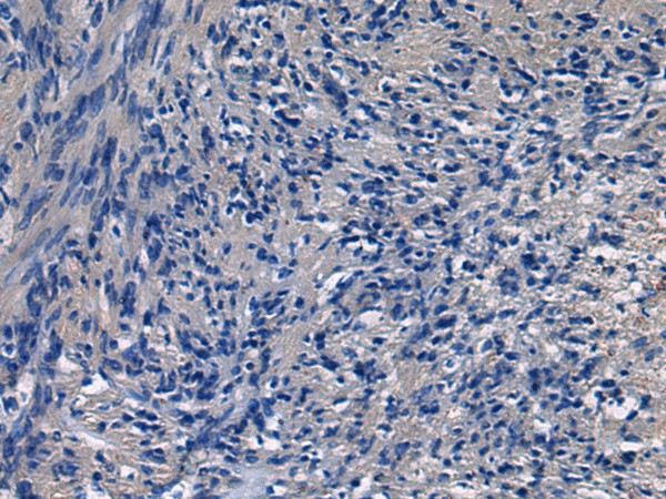 Immunohistochemistry of paraffin-embedded Human brain tissue  using ICA1 Polyclonal Antibody at dilution of 1:50(?200)