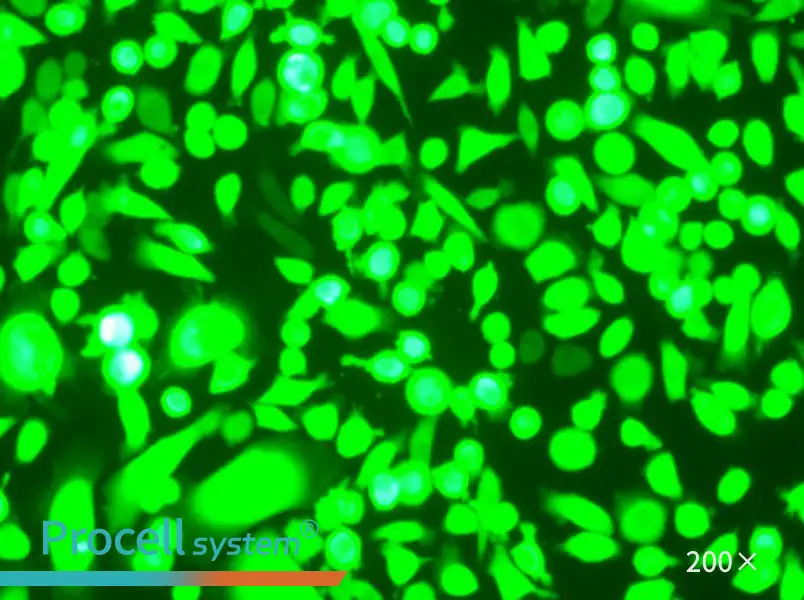 AGS-GFP - 4