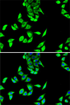 Immunofluorescence analysis of U2OS cells using FH Polyclonal Antibody