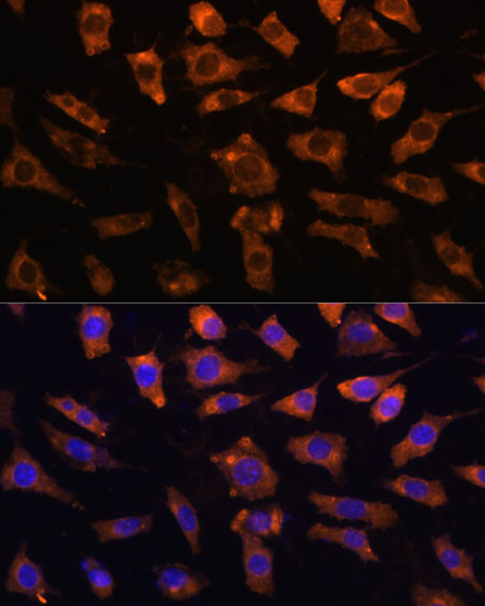 Immunofluorescence analysis of L929 cells using CYR61 Polyclonal Antibody at dilution of  1:100. Blue: DAPI for nuclear staining.