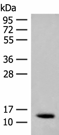 Western blot analysis of Human fetal brain tissue lysate  using AKAP7 Polyclonal Antibody at dilution of 1:200