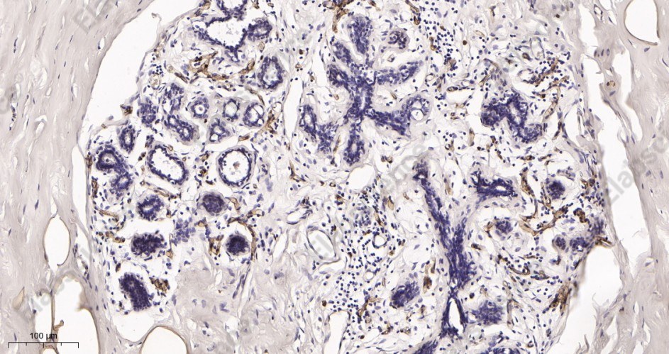 Recombinant FABP4 Monoclonal Antibody - 2
