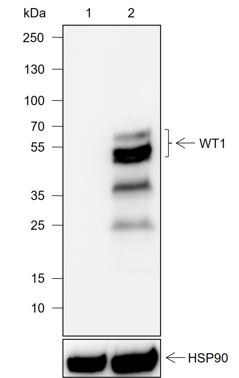 Recombinant WT1 Monoclonal Antibody-searchlist-1