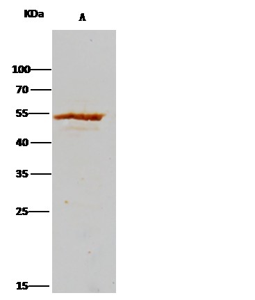 Recombinant ADSL/Adenylosuccinate Lyase Monoclonal Antibody - small - 3