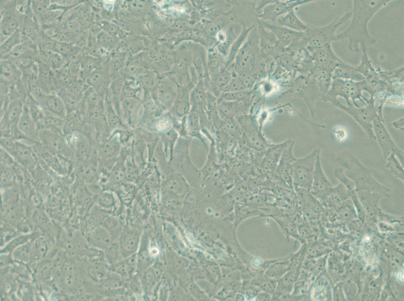 HCC38 Cell Complete Medium - 6