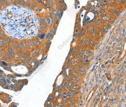 ACOT11 Polyclonal Antibody - 2