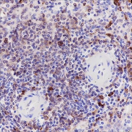 Recombinant HLA-DRA Monoclonal Antibody - 2