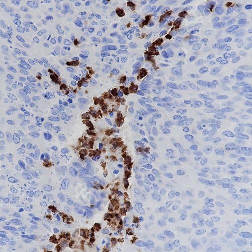 Recombinant CD15/SSEA1 Monoclonal Antibody - 2