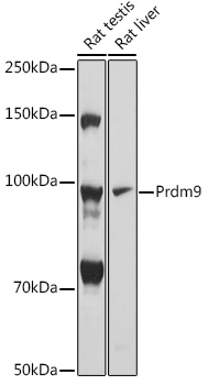 Western blot analysis of extracts of various cell lines using Prdm9 Polyclonal Antibody at 1:1000 dilution.