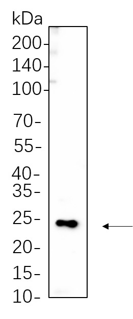 Recombinant Phospho-MYL9 (Thr18/Ser19) Monoclonal Antibody-searchlist-1