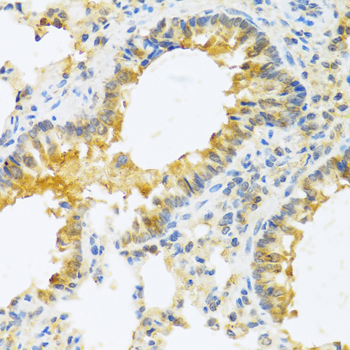 Immunohistochemistry of paraffin-embedded Mouse lung using IL20 Polyclonal Antibody at dilution of  1:100 (40x lens).