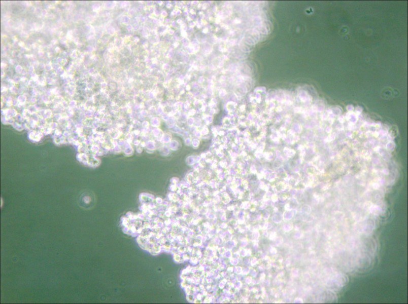 NCI-H146 [H146] Cell Complete Medium - small - 6