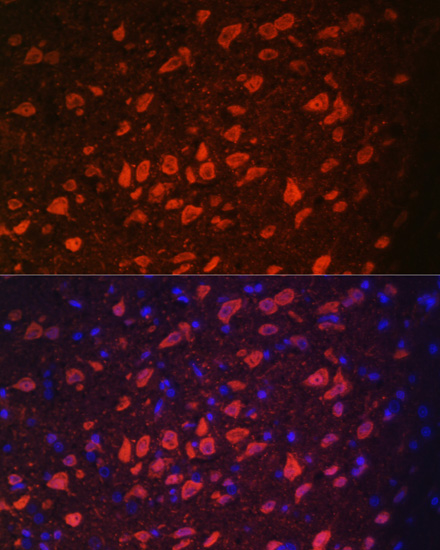 Immunofluorescence analysis of Rat brain using TRPM2 Polyclonal Antibody at dilution of  1:100. Blue: DAPI for nuclear staining.